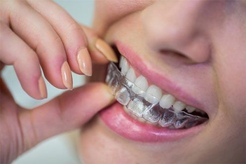Ortodontia, ramo da odontologia na area dental, dedica-se à correção da posição dos dentes e maxilares.