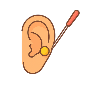 Orelha humana com agulhas aplicadas e esfera dourada, representando a estimulação de pontos auriculares.